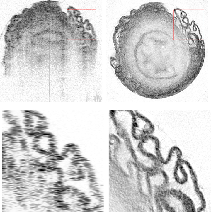 The image quality of a normal OCT scan (left) and a new OCRT scan (right) are demonstrated with a mouse vas deferens sample. Note how the OCT scan quickly deteriorates with depth while the OCTR scan produces a complete image (top), and the increase in fine detail and reduction in noise between the two (bottom).